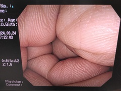 大腸ビデオスコープ｜CF-H260AI｜オリンパスメディカルシステムズ株式会社の写真7枚目