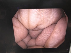 上部消化管汎用ビデオスコープ｜GIF-H190N｜オリンパスメディカルシステムズ株式会社の写真8枚目