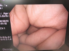 Video Colonoscope｜PCF-Q260JI｜Olympus Medical Systems photo6