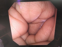 上部消化管汎用ビデオスコープ｜GIF-XP290N｜オリンパスメディカルシステムズ株式会社の写真8枚目