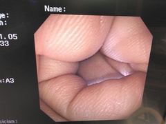 Video Gastroscope｜GIF-XP240｜Olympus Medical Systems photo8