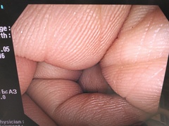 大腸ビデオスコープ｜CF-Q240I｜オリンパスメディカルシステムズ株式会社の写真8枚目