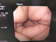 Video Gastroscope｜GIF-XQ240｜Olympus Medical Systems photo8