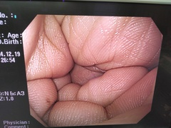 上部消化管汎用ビデオスコープ｜GIF-H260｜オリンパスメディカルシステムズ株式会社の写真8枚目