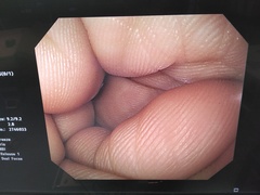 上部消化管汎用ビデオスコープ｜GIF-Q260｜オリンパスメディカルシステムズ株式会社の写真8枚目