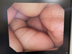 大腸ビデオスコープ｜CF-H260AI｜オリンパスメディカルシステムズ株式会社の写真6枚目