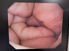 上部消化管汎用ビデオスコープ｜GIF-H260｜オリンパスメディカルシステムズ株式会社の写真7枚目