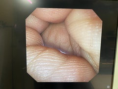 Video Gastroscope｜GIF-XP260NS｜Olympus Medical Systems photo8