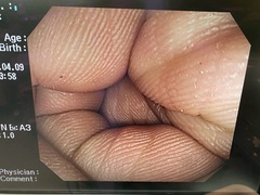 Video Colonoscope｜CF-Q240I｜Olympus Medical Systems photo8