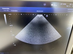 Ultrasound System(Color)｜Xario100 TUS-X100｜Canon Medical Systems photo8