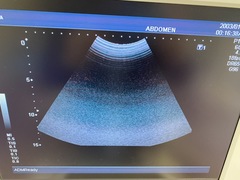 Ultrasound system(Color)｜SSA-580A Nemio XG｜Canon Medical Systems photo8