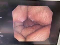 Video Gastroscope｜GIF-XP240｜Olympus Medical Systems photo8