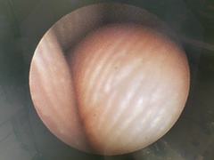 Video Bronchoscope｜BF-P260F｜Olympus Medical Systems photo8