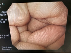 上部消化管汎用ビデオスコープ｜GIF-H260｜オリンパスメディカルシステムズ株式会社の写真8枚目