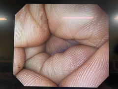 Video Gastroscope｜GIF-H290｜Olympus Medical Systems photo8