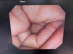Video Gastroscope｜GIF-Q260J｜Olympus Medical Systems photo8