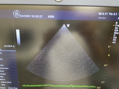 Ultrasound system(Color)｜LOGIQ P6｜GE Healthcare photo8