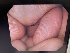 上部消化管汎用ビデオスコープ｜GIF-Q260｜オリンパスメディカルシステムズ株式会社の写真8枚目