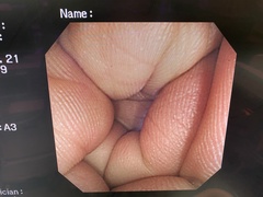 Video Colonoscope｜CF-240I｜Olympus Medical Systems photo8