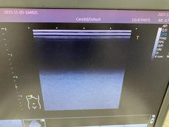 Ultrasound system｜Viamo α100　TUS-VC100｜Canon Medical Systems photo8