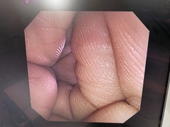 Video Transnasal Gastroscope｜GIF-XP260N｜Olympus Medical Systems photo8