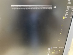 超音波診断装置｜LOGIQ S7 Expert｜GEヘルスケアの写真8枚目