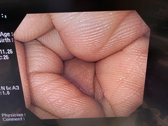 上部消化管汎用ビデオスコープ｜GIF-PQ260｜オリンパスメディカルシステムズ株式会社の写真8枚目