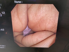 Video Gastroscope｜GIF-XP260｜Olympus Medical Systems photo8