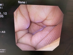 Video Gastroscope｜GIF-XP260NS｜Olympus Medical Systems photo8