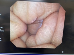 上部消化管汎用ビデオスコープ｜GIF-Q260｜オリンパスメディカルシステムズ株式会社の写真8枚目