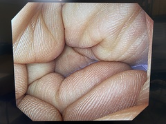 Video Gastroscope｜GIF-H290｜Olympus Medical Systems photo8