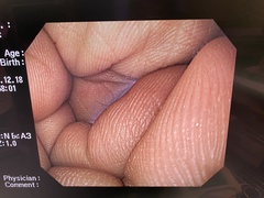 上部消化管汎用ビデオスコープ｜GIF-Q260｜オリンパスメディカルシステムズ株式会社の写真8枚目