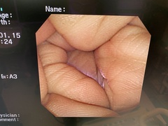 Video Gastroscope｜GIF-XP260｜Olympus Medical Systems photo7