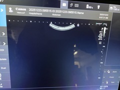 Ultrasound System(Color)｜Viamo SV7   CUS-VSV7｜Canon Medical Systems photo8