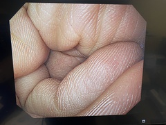 上部消化管汎用ビデオスコープ｜GIF-H260｜オリンパスメディカルシステムズ株式会社の写真8枚目