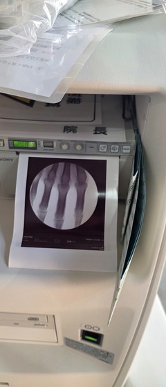 ミニCアーム｜Fluoroscan InSight 2｜ホロジックジャパン株式会社の写真8枚目