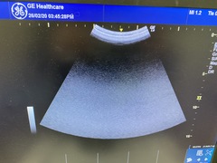 超音波診断装置｜LOGIQ e Premium｜GEヘルスケアの写真8枚目