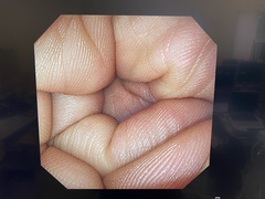 Video Gastroscope｜GIF-XP290N｜Olympus Medical Systems photo8