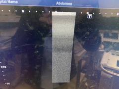 超音波診断装置｜Aplio 500 TUS-A500｜キヤノンメディカルシステムズの写真8枚目