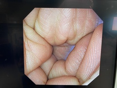 Video Gastroscope｜GIF-XP290N｜Olympus Medical Systems photo8