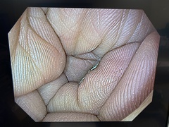 上部消化管汎用ビデオスコープ｜GIF-H190N｜オリンパスメディカルシステムズ株式会社の写真8枚目