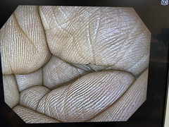 上部消化管汎用ビデオスコープ｜GIF-H190N｜オリンパスメディカルシステムズ株式会社の写真8枚目