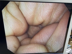 上部消化管汎用ビデオスコープ｜GIF-H290｜オリンパスメディカルシステムズ株式会社の写真8枚目