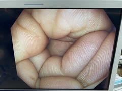 大腸ビデオスコープ｜PCF-H290ZI｜オリンパスメディカルシステムズ株式会社の写真8枚目