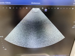 Ultrasound System(Color)｜Xario100 TUS-X100｜Canon Medical Systems photo8