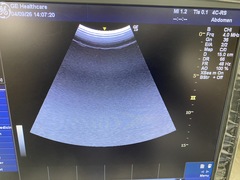 Ultrasound system(Color)｜LOGIQ e Expert｜GE Healthcare photo8