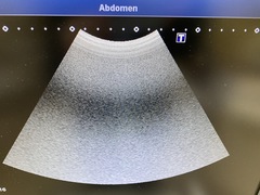 超音波診断装置(カラードプラ)ＬＣＤ｜Aplio 400 TUS-A400｜キヤノンメディカルシステムズの写真8枚目