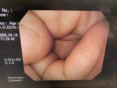 Video Gastroscope｜GIF-Q260｜Olympus Medical Systems photo8