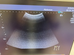 Ultrasound system(Color)｜SSA-580A Nemio XG｜Canon Medical Systems photo8