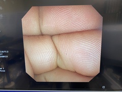 Video Duodenoscope｜JF-260V｜Olympus Medical Systems photo8